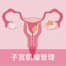 子宫肌瘤管理