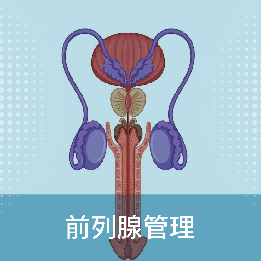前列腺管理