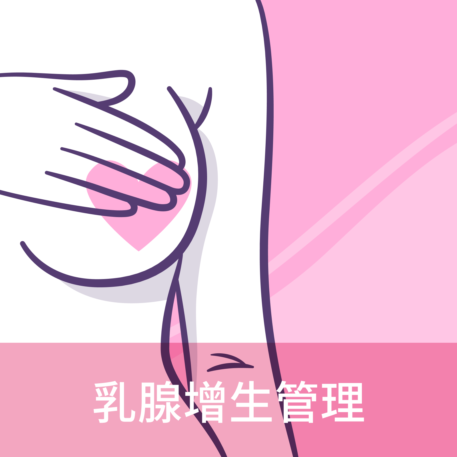 Breast hyperplasia management